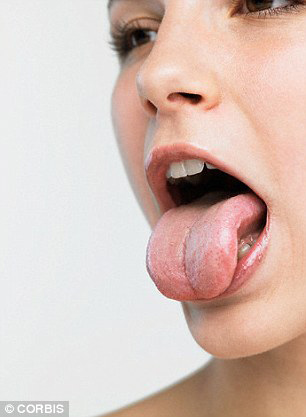 dau hieu benh cua luoi - Lưỡi thay đổi là dấu hiệu của những loại bệnh gì?